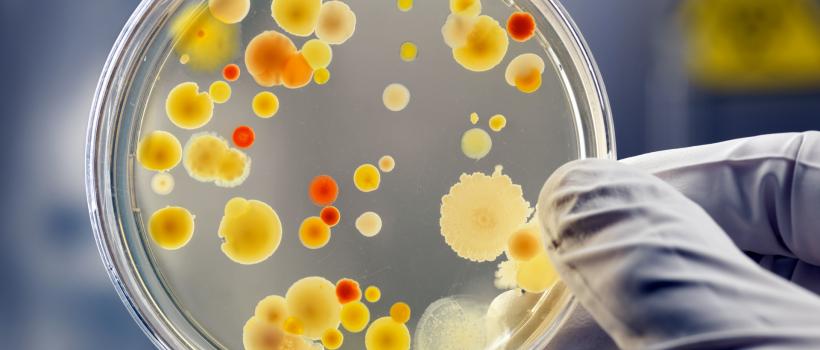 Microbial API Market