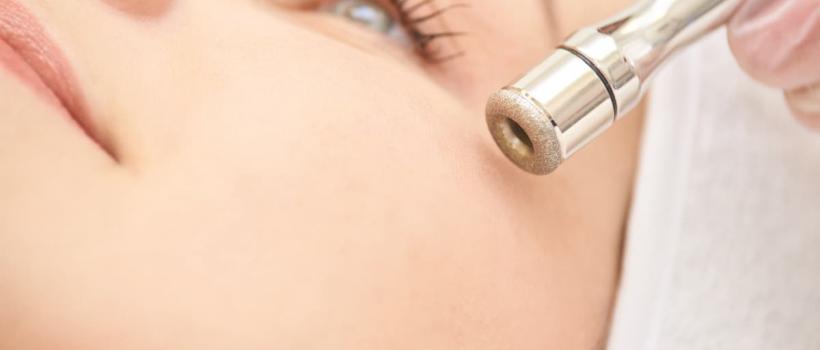 Microdermabrasion Devices