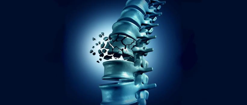Minimally Invasive Vertebral Compression Fracture Treatments 