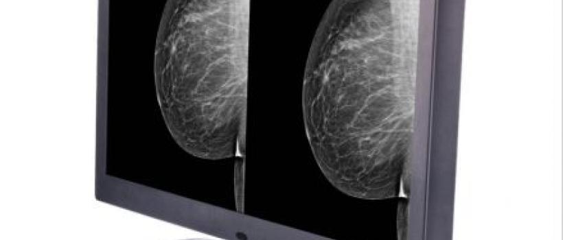 Monochrome Medical Monitor Market