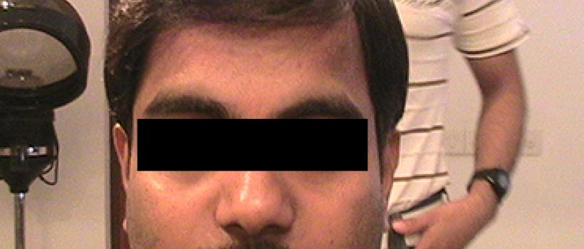 Natural Hair Wigs For Men in Mumbai 