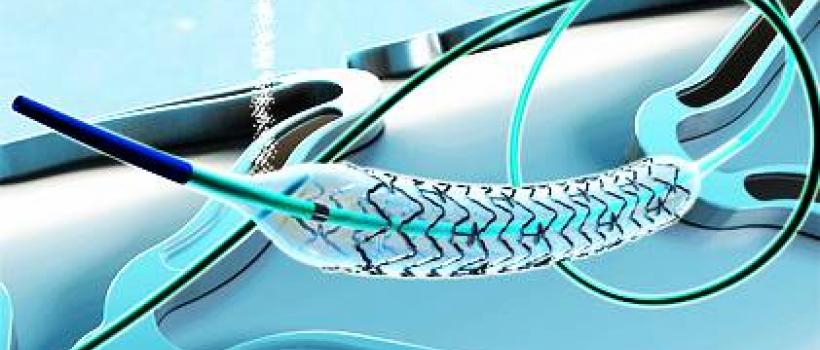 Neurovascular Devices/Interventional Neurology