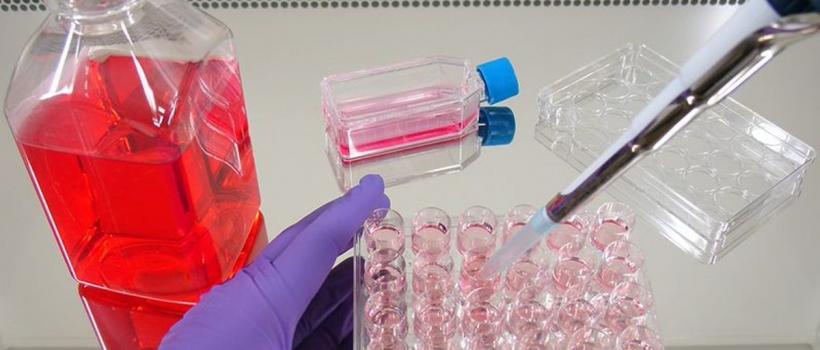 Newborn Calf Serum Market