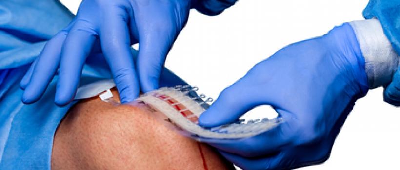 Noninvasive Surgical Wound Closure Market