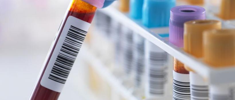 Nucleic Acid Testing (NAT) Analyzers and Reagents