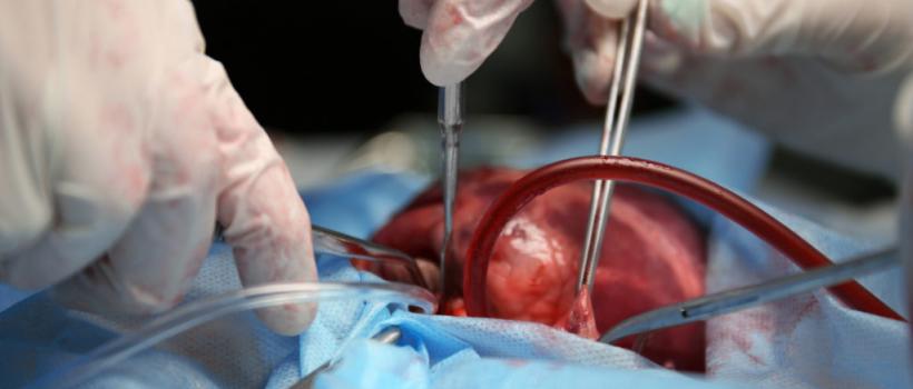 Organ Transplantation Immunosuppressive Drug market