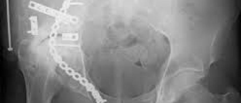 Orthopaedic Oncology Market