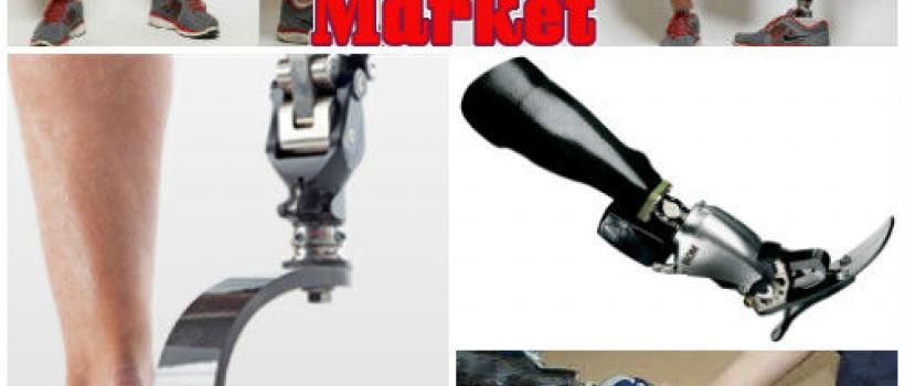 Orthopedic Prosthetics