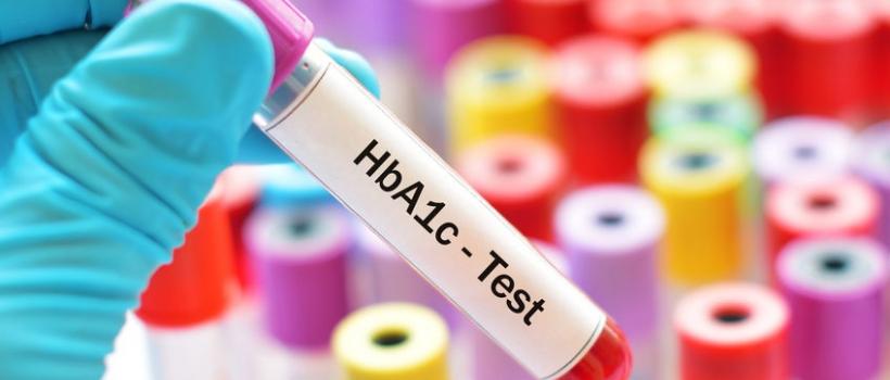  POC HbA1C Testing Market