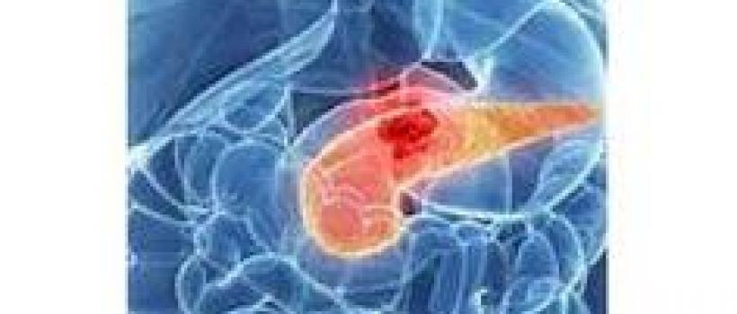 Global Pancreatic Cancer Pipelines .