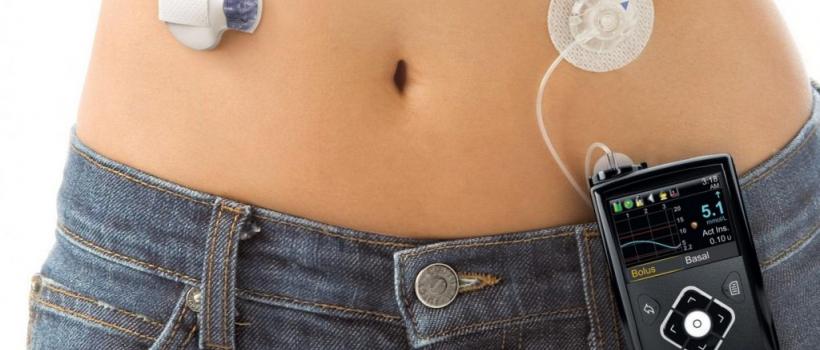 Patch Insulin Pumps