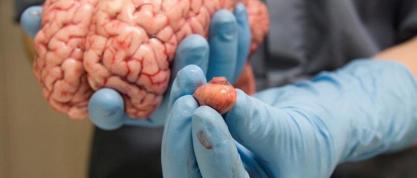 Pituitary Cancer Market
