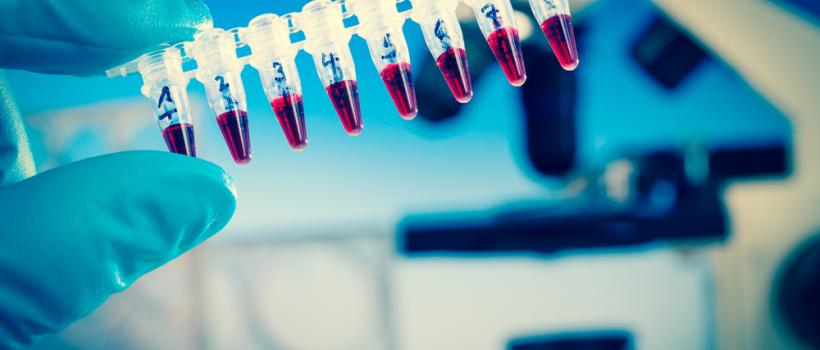 Global Plasma Protein Therapeutic Market