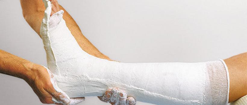 Plaster casting tape, Plaster casting tape Market, Plaster casting tape Market Growth, plaster cast tape mask making, plaster of paris casting tape