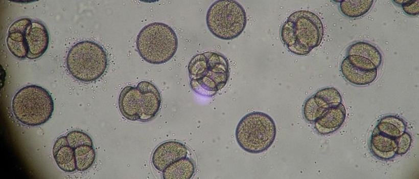 Preimplantation-Genetic-Testing