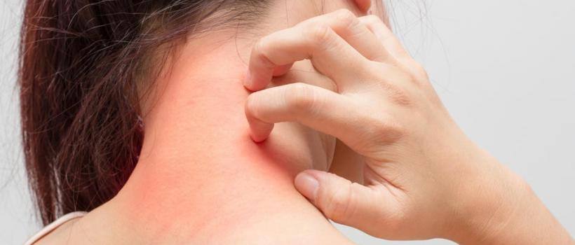 Pruritus Therapeutics Market