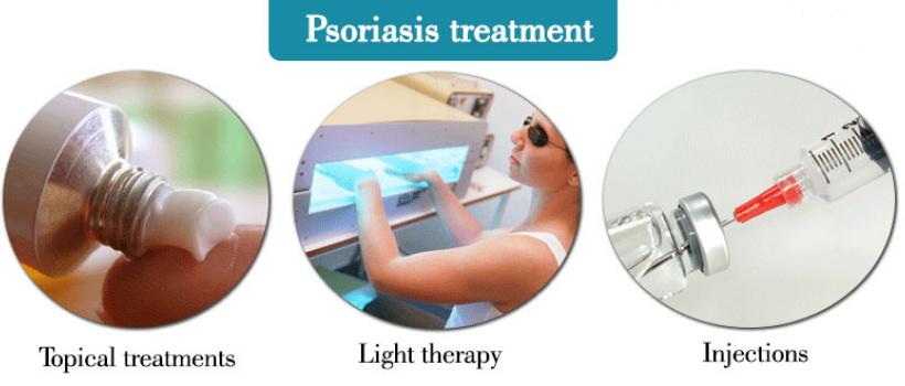 Psoriasis Treatment Market