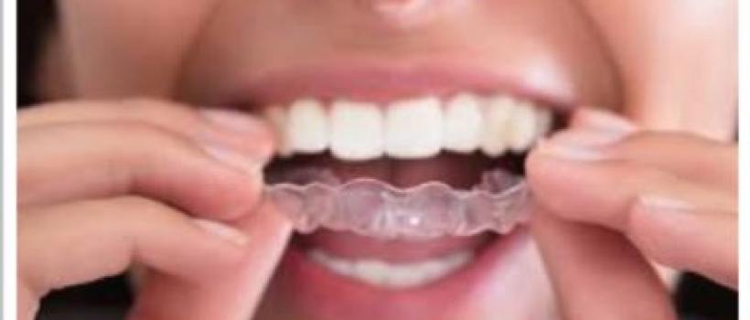 Why Bi-Annual Dental Checkup is Important?