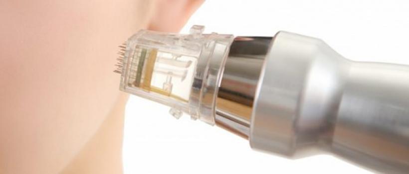 Radiofrequency Industry 