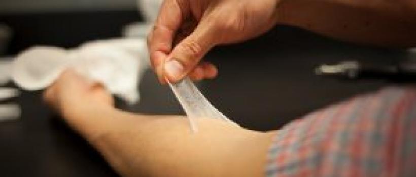 Regenerative Artificial Skin Market