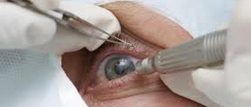 Retinal Surgery Devices