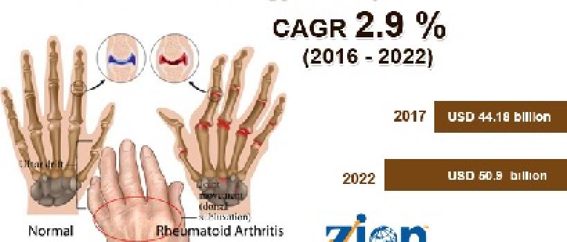 Rheumatology Therapeutics Market
