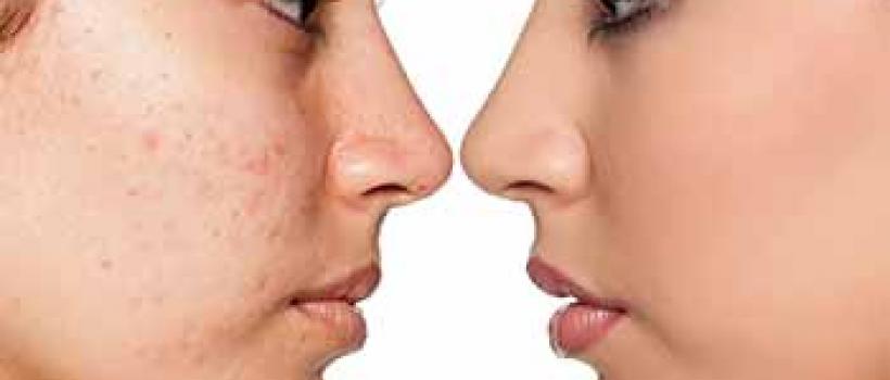 Scar Removal Treatment Market
