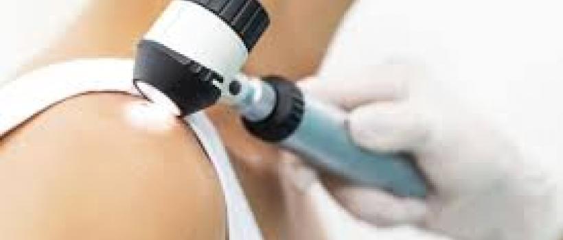 Skin Cancer Diagnostics