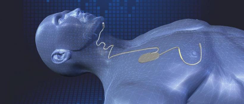 Sleep Apnea Devices