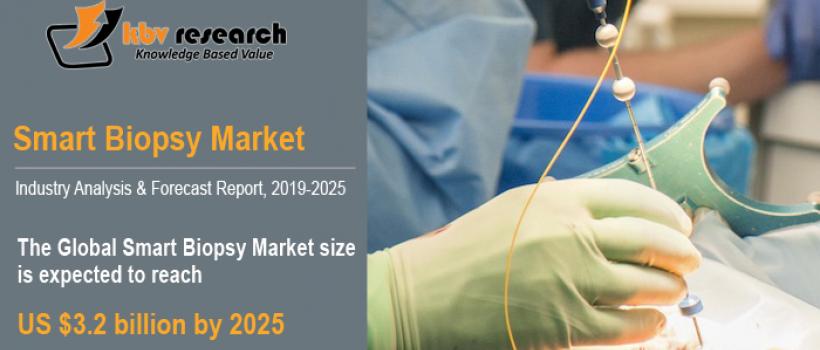 Smart Biopsy Market