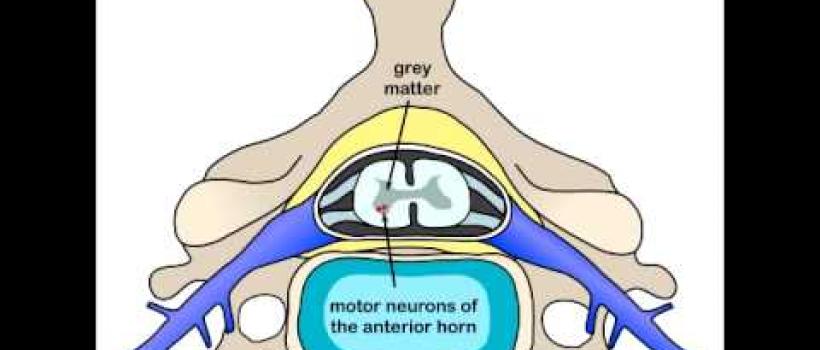 Spinal Muscular Atrophy Market