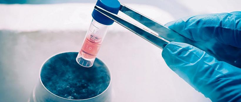 Stem Cell Banking
