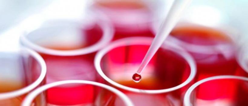 Stem Cell Transplantation