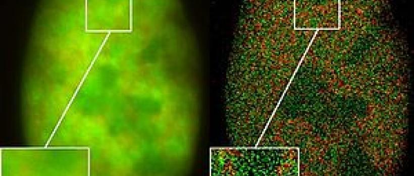 Super-resolution Microscopes Market