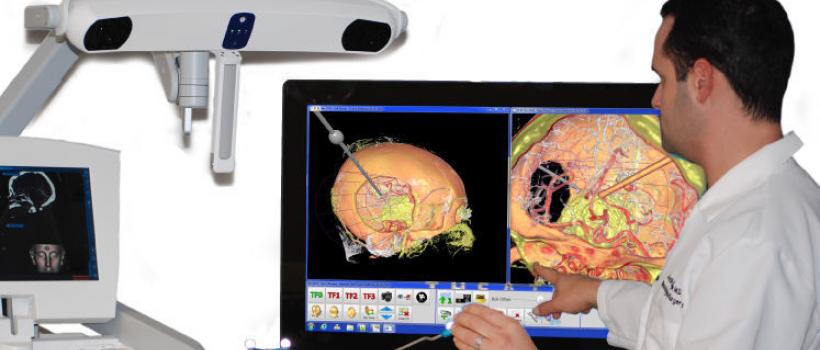Surgical Navigation Systems Market