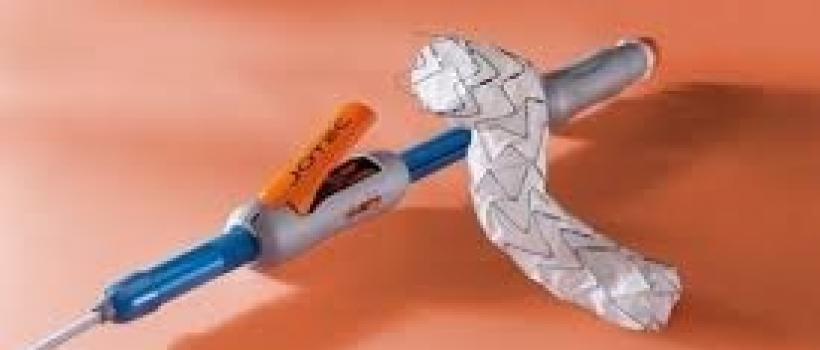Thoracic Aortic Stent Graft