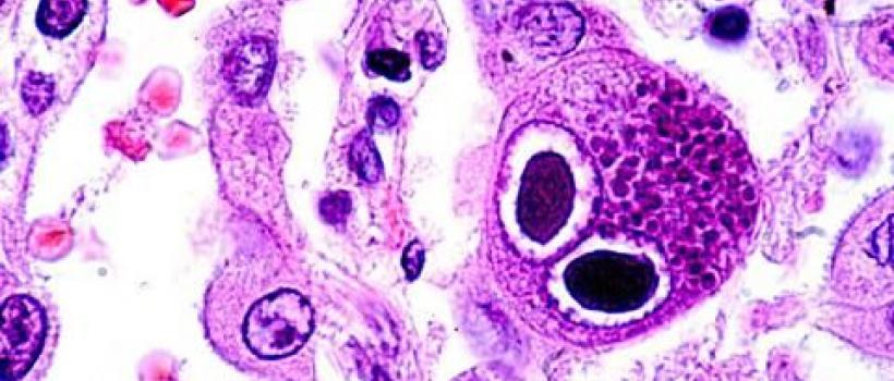 Tissue Engineering and Regeneration Market