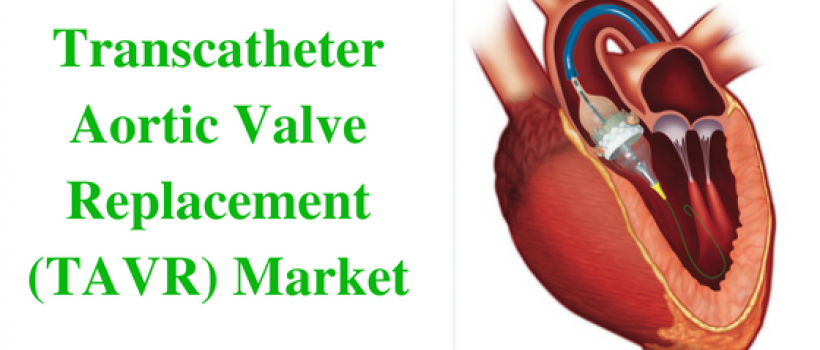 market research report