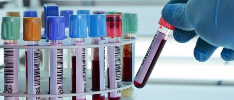 Transfusion Diagnostic Equipment Market