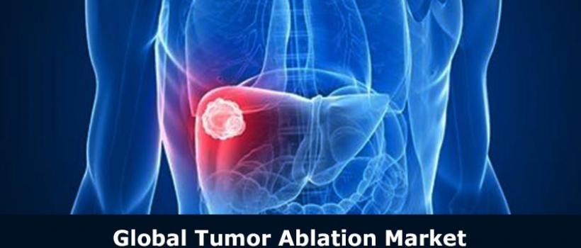 Tumor Ablation Market