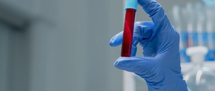 Urea Cycle Disorder Treatment Market 