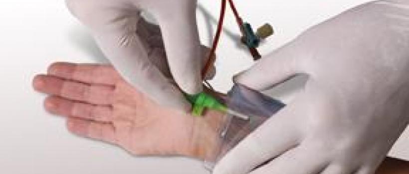 Vascular Closing Device