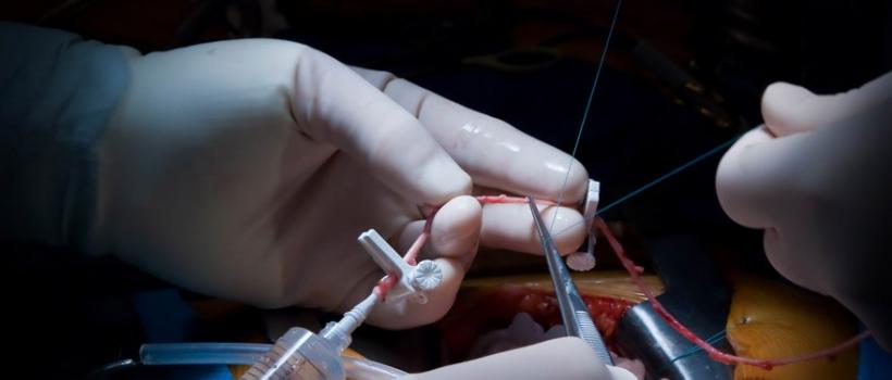 Vascular Graft Market