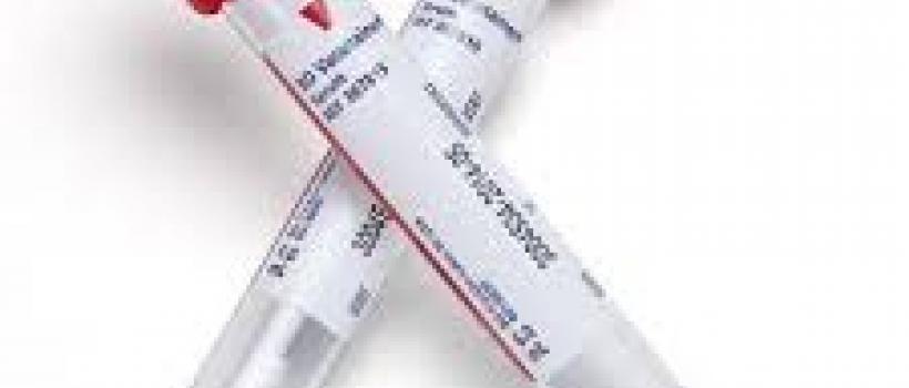 World Venous Blood Collection Tube Market 