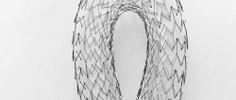 Venous Stents Sales