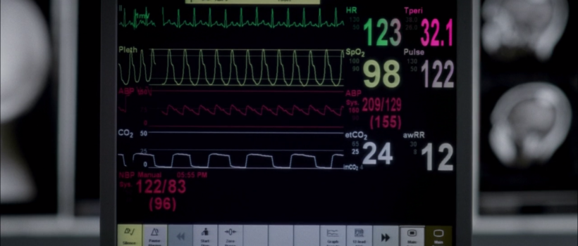 Vital Signs Monitors