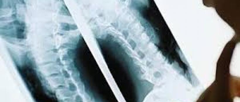 X-Ray Contrast Agents