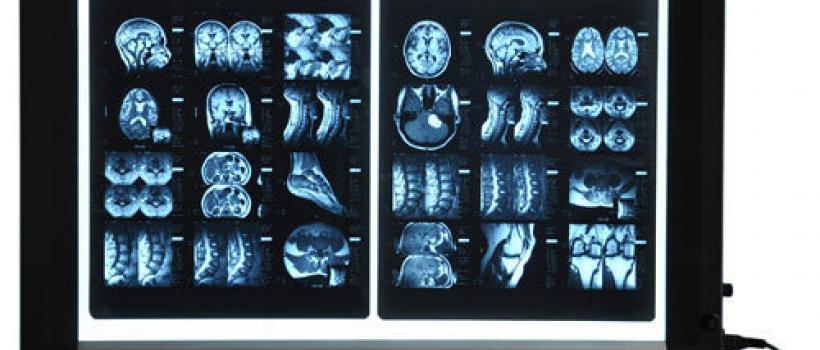 XRay Film Viewers