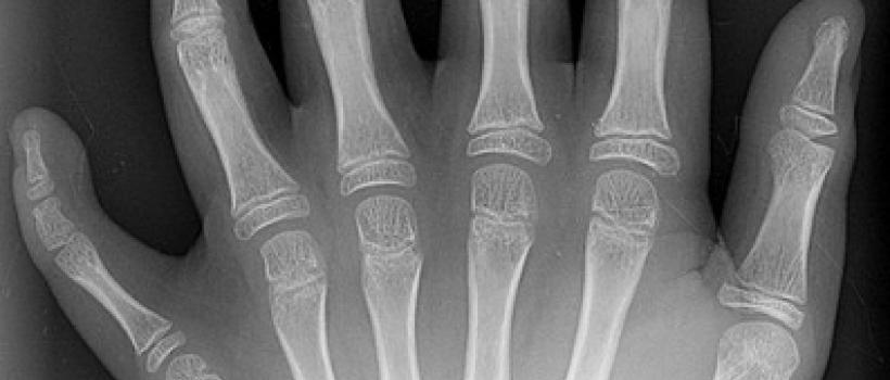 X-ray Computed Tomography System
