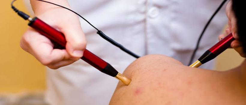 Best Acupuncture Doctor In South Delhi